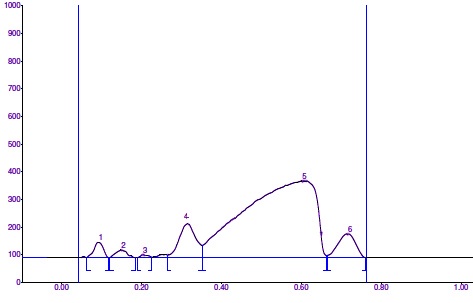 Fig: HPTLC finger print profile of chloroform extract of Milagathi chooranam at 540 nm.